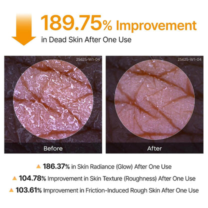 Kojic Acid and Turmeric Exfoliating Spray