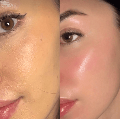 Kojic Acid and Turmeric Exfoliating Spray