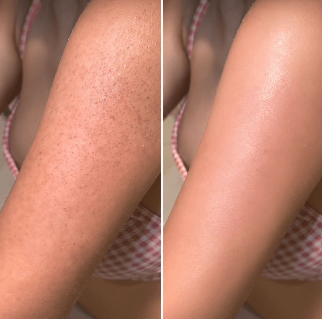 Kojic Acid and Turmeric Exfoliating Spray