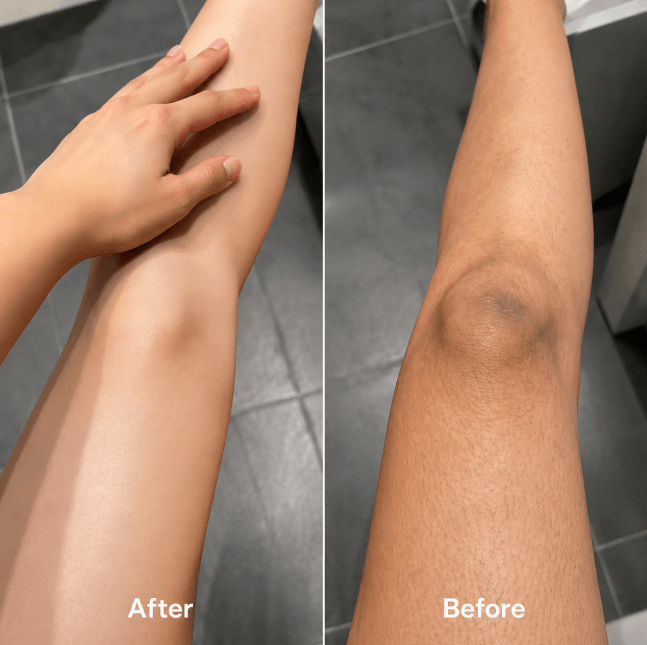 Kojic Acid and Turmeric Exfoliating Spray