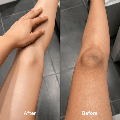 Kojic Acid and Turmeric Exfoliating Spray