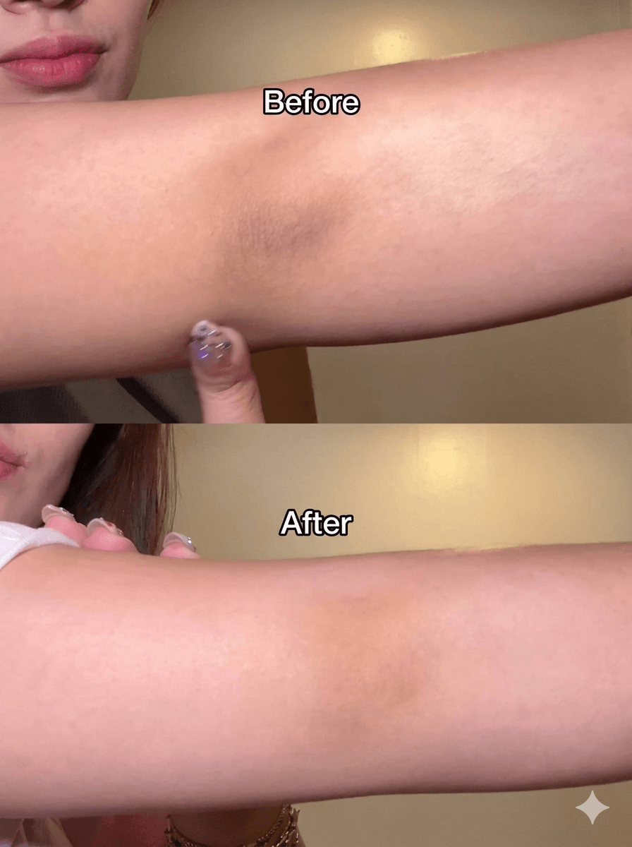 Kojic Acid and Turmeric Exfoliating Spray