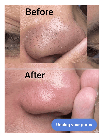 Kojic Acid and Turmeric Exfoliating Spray