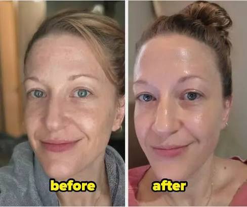 Kojic Acid and Turmeric Exfoliating Spray